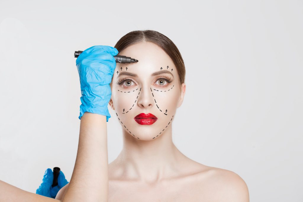 marking face for facial balancing dermal fillers